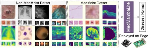 MedMambaLite: Hardware-Aware Mamba for Medical Image Classification Figure 1