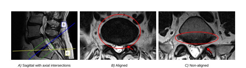 Rendering Novel Views of MRI Using 3D Gaussian Splatting Figure 1