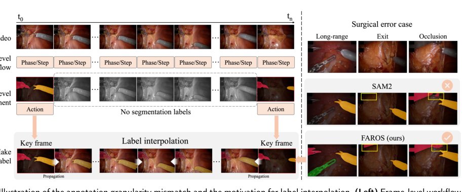Temporally Consistent Label Interpolation for Robust Surgical Multi-Task Learning under Challenging Conditions Figure 1