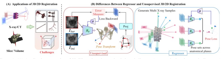 LayersReg: A Layer-by-Layer Progressive Regressor for Reliable Intraoperative 3D/2D Registration Figure 1