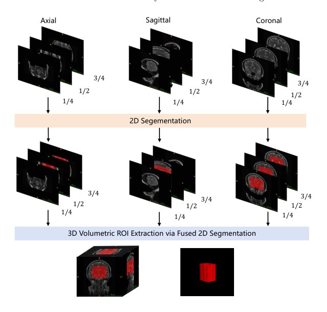 Intracranial Aneurysm Classification and Segmentation via Tri-Axial ROI and Multi-Task Learning Figure 1