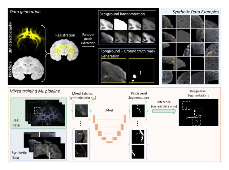 Tractography-Driven Synthetic Data Generation for Fiber Bundle Segmentation in Tracer Histology Figure 1