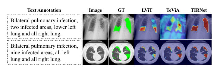 Text as Illumination: Spatial Contrastive Retinex Learning for Language-guided Medical Image Segmentation Figure 1