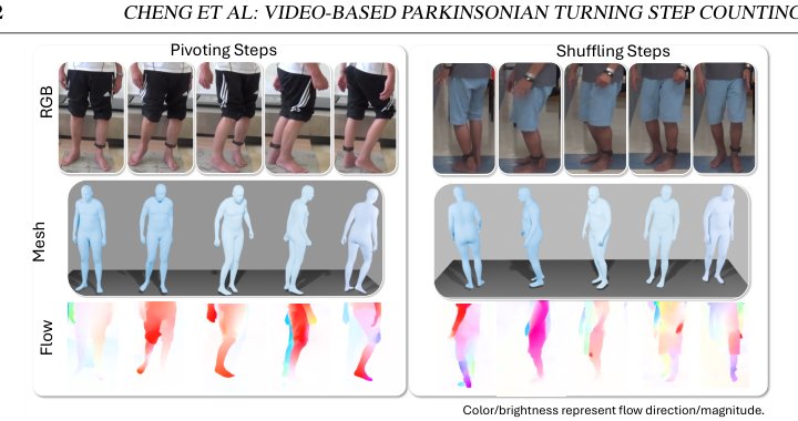 Every Step of the Way: Video-based Parkinsonian Turning Step Counting Figure 1