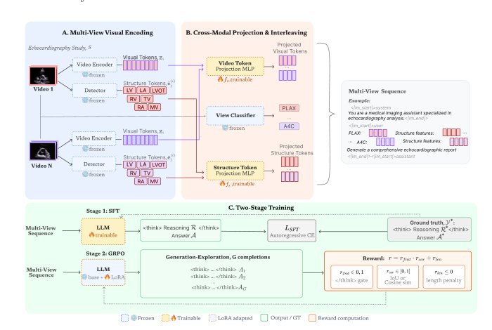 EchoSonar-R: A Multi-View Reasoning-Enabled Model for Disease Classification and Report Generation in Echocardiography Figure 1