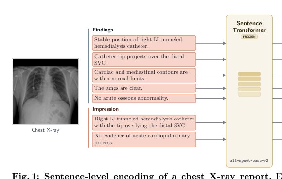 Transition-Aware best-of-N sampling for Longitudinal Chest X-ray Reports Figure 1