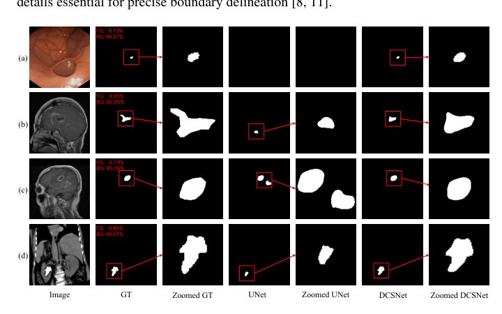 DCSNet: Multiscale Feature Aggregation for Small Medical Object Segmentation with Detection-guided Hierarchical Cropping Figure 1