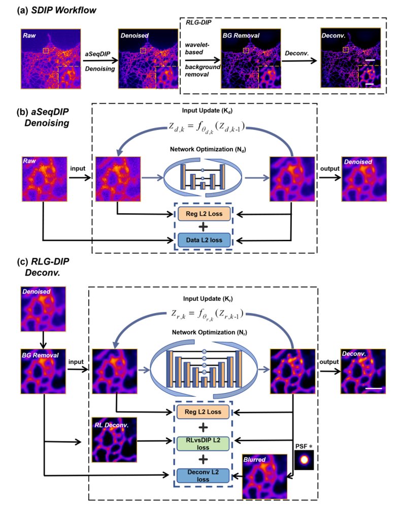 A Zero-Shot Deep Image Prior Framework for Denoising and Deconvolution in Fluorescence Microscopy Figure 1
