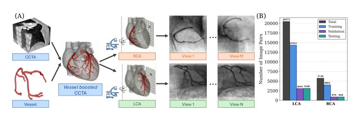 Anatomy-Grounded Synthetic Coronary Angiography for Geometry-Informed Multi-View Matching Figure 1