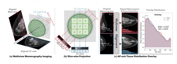 MammoFlow: Multiview Mammogram Synthesis with Anatomically Consistent Flow Matching Figure 1