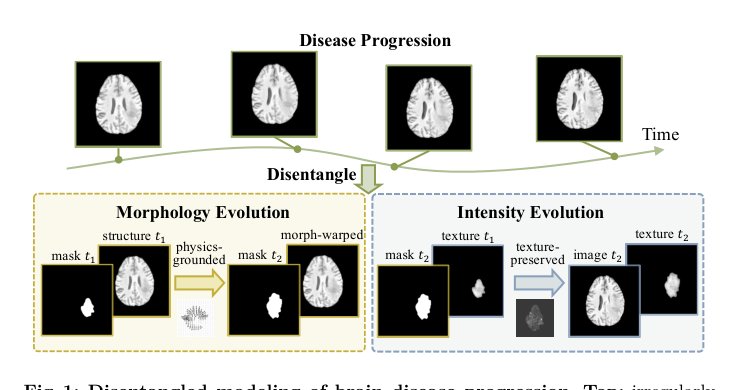 Physics-Grounded Disentangled Flow Modeling for Brain Disease Progression Trajectory Figure 1