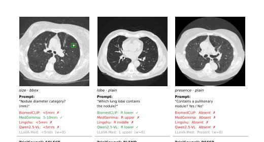 When Does Synthetic CT Transfer? A Label-Free Donor/Host Diagnostic for Medical Vision-Language Model Routing on Real Lung CT Figure 1