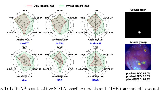 Robust Zero-shot Anomaly Detection under Limited Auxiliary Anomaly Priors Figure 1