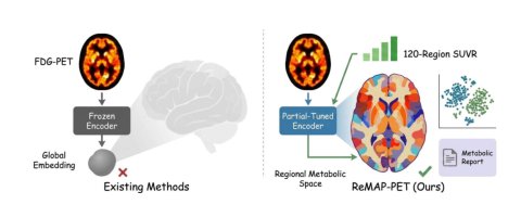 ReMAP-PET: Beyond Visual Understanding -- Learning Region-Guided Metabolic Alignment Semantics from Brain PET Figure 1