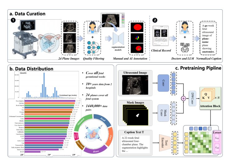 SonoCLIP: Mask-Guided Region-Aware Vision-Language Pretraining for Fetal Ultrasound Analysis Figure 1