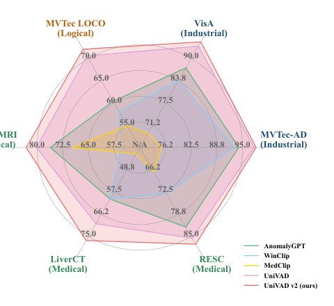 UniVAD v2: Unified Visual Anomaly Detection via Support-Conditioned Boundary Construction Figure 1