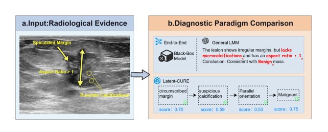 Latent-CURE for Breast Cancer Diagnosis Figure 1