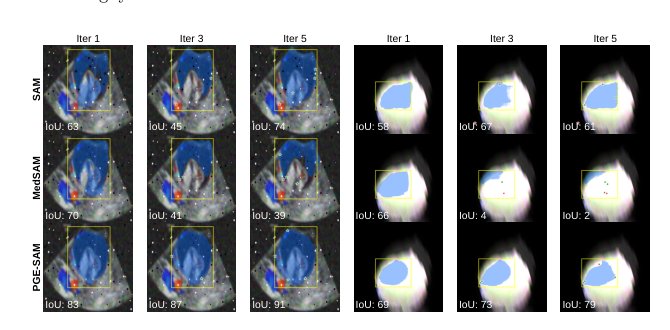 PGE-SAM: Prompt-Guided Feature Enhancement for Interactive Segmentation under Degradation Figure 1