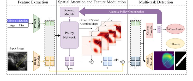 Learning Where to Look: A Reinforcement Learning Framework for Robust Micro-Ultrasound Prostate Cancer Detection Figure 1
