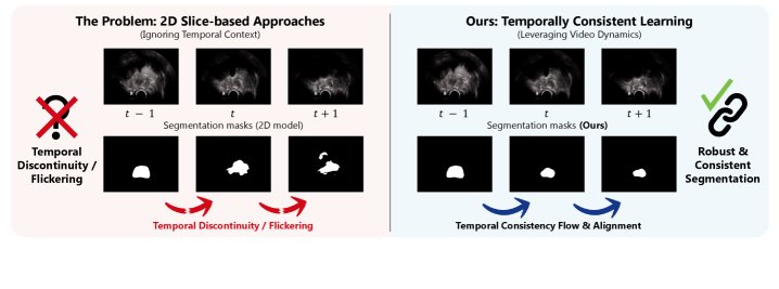 Distilling Temporal Coherence into 2D Networks for Transrectal Ultrasound Prostate Video Segmentation Figure 1