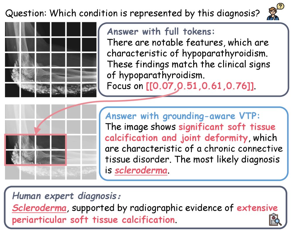 Token-Sparse Medical Multimodal Reasoning via Dual-Stream Reinforcement Learning Figure 1