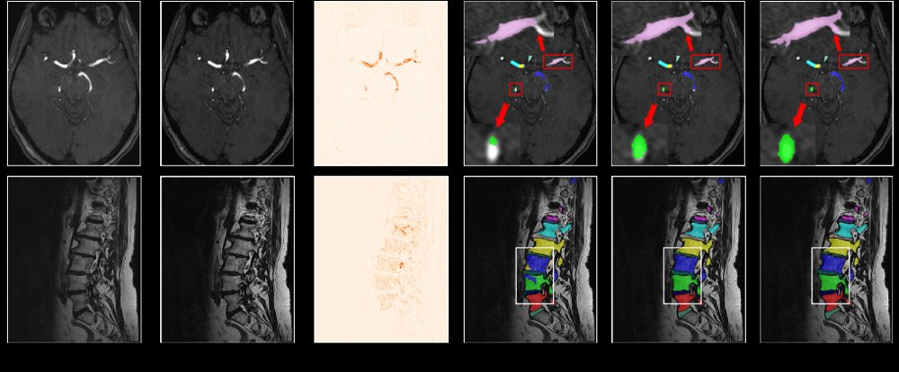 Towards Voxel Spacing Consistency for Medical Image Segmentation Figure 1