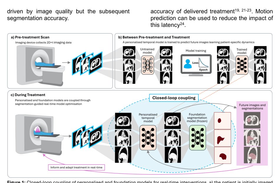 Closed-loop coupling of personalised and foundation models for real-time treatment guidance with MRI Figure 1