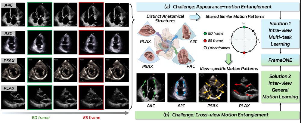 FrameONE: Hierarchical Motion Modeling for Universal Multi-View Echocardiographic Keyframe Detection Figure 1