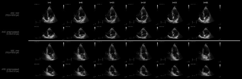 EchoRisk: A Multicentre Echocardiography Dataset and Benchmark for Cardio-Oncology Figure 1