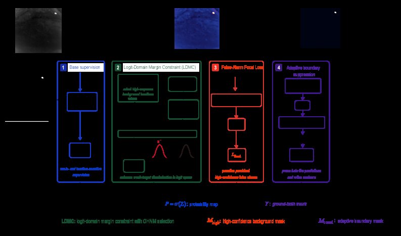 Boosting Infrared Small Target Detection via Logit-Domain Contrast and Adaptive Shape Refinement Figure 1