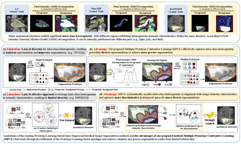 Embracing Intra-Class Heterogeneity for Semi-Supervised Medical Image Segmentation: From Diversity to Precision Figure 1