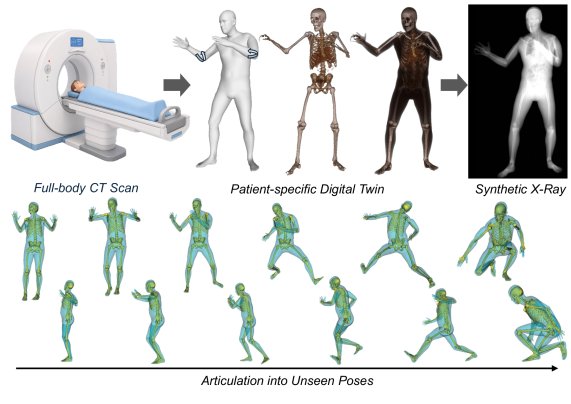 Patient-Specific Articulated Digital Twins from a Single Full-Body CT Scan Figure 1