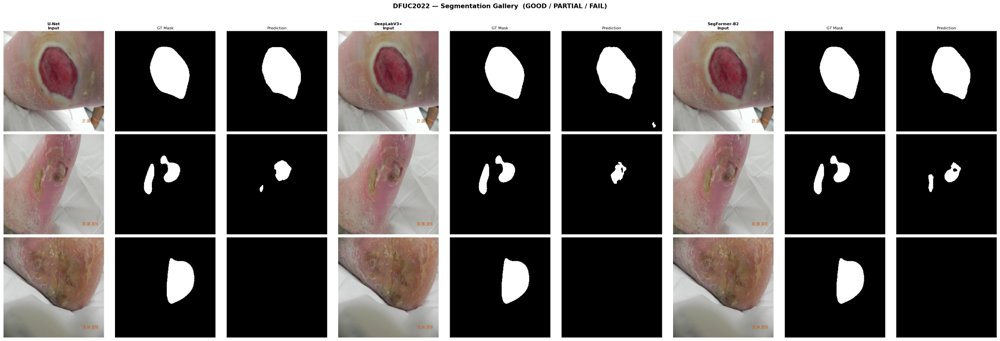 Do Diabetic Foot Ulcer Segmentation Models Generalize? A Cross-Dataset Benchmark of CNN and Transformer Architectures Figure 1