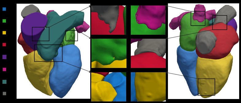From Raw Segmentations to Simulation-Ready Cardiac Meshes: An Automated Framework for Anatomical Reconstruction and Virtual Cohort Generation Figure 1