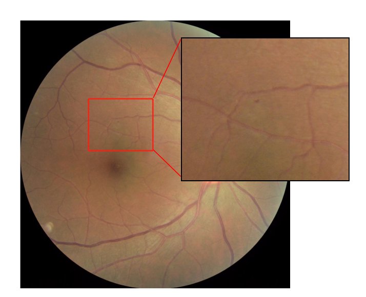 An automated method of identifying incorrectly labelled images based on the sequences of loss functions of deep learning networks Figure 1