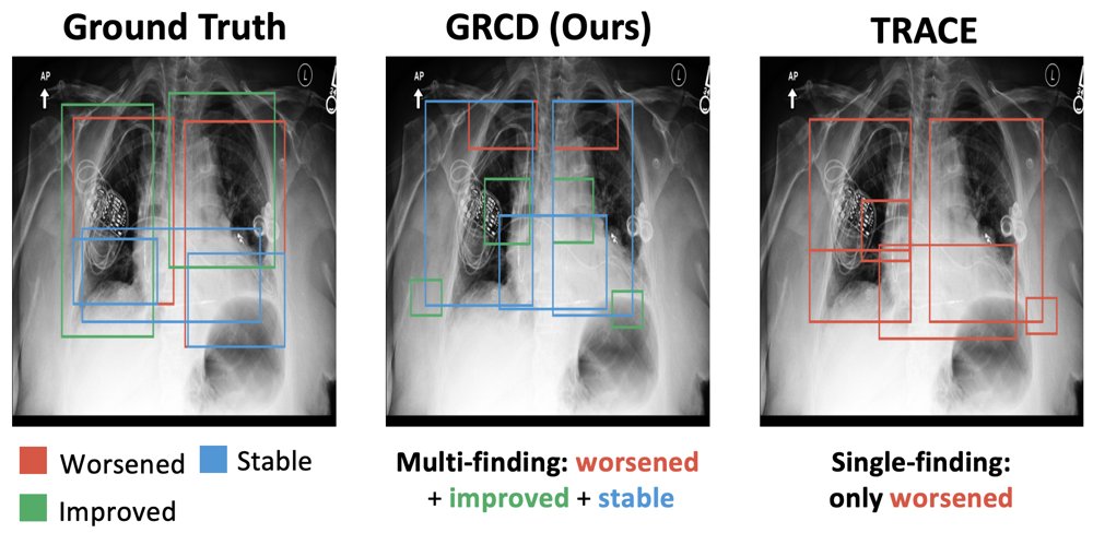 GRCD: Grounded Region Change Detection for Multi-Finding Chest X-Ray Pairs Figure 1