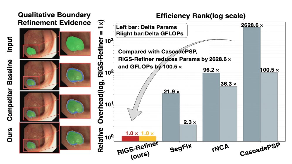 RIGS-Refiner: Risk-Guided Recursive Refinement in Prediction Space for Colonoscopy Polyp Segmentation Figure 1