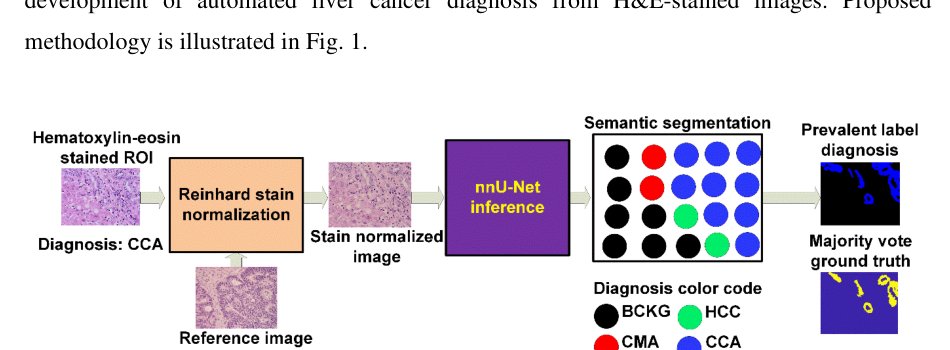 Semantic Segmentation-Driven Image-Level Diagnosis of Liver Cancers in Hematoxylin and Eosin Histopathology Images Figure 1