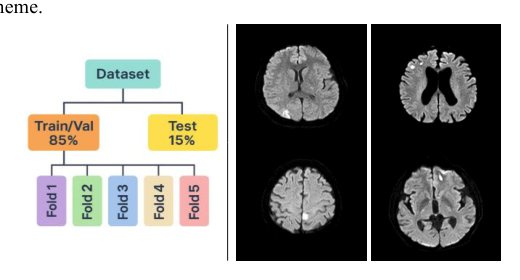 EPRA U-Net: An Efficient Pyramid Residual Attention Framework for Accurate Infarct Segmentation in Diffusion-Weighted MRI Figure 1
