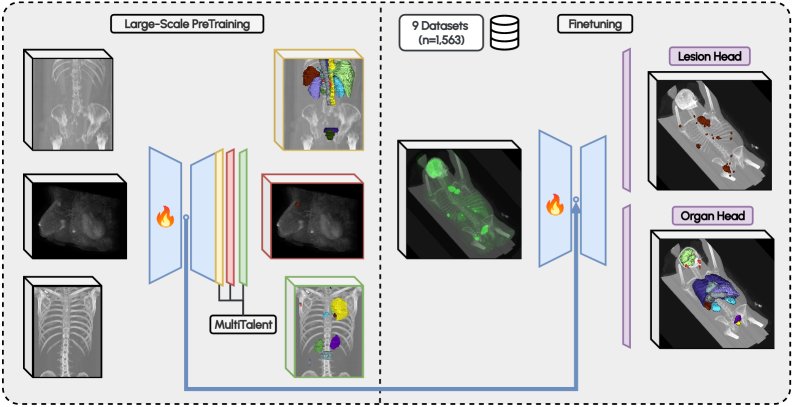 GLOW-FDG: Generalized cancer LesiOn Whole-body segmentation model for $^{18}$F-FDG-PET/CT Figure 1