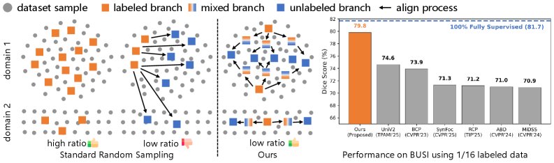 Beyond Random Sampling: Distribution-Aware Alignment for Semi-Supervised Medical Image Segmentation Figure 1