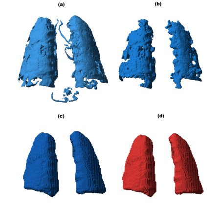 Spatial Graph Representation and Morphometric Analysis of the Pulmonary Vascular Tree From Computed Tomography Using Multi-Scale Hessian-Based Filter Fusion and TEASAR Skeletonization Figure 1