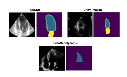 Comparison of Loss Functions for Robust Deep Learning-based Echocardiography Segmentation when Learning with Partially Labelled Data from Multiple Domains Figure 1