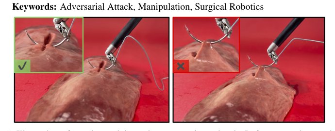 Adversarial Attacks on Learned Policies for Surgical Robotic Tasks Figure 1