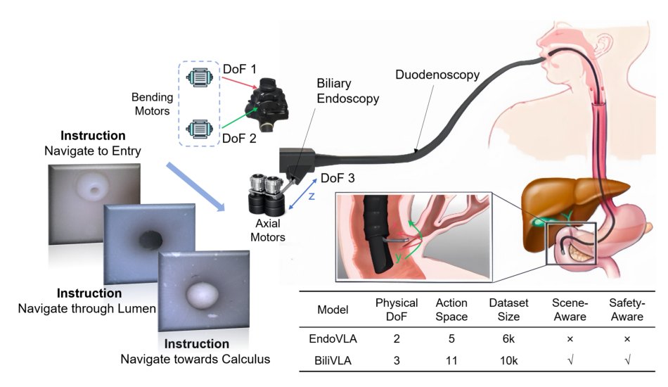 BiliVLA: Scene-Aware Vision-Language-Action Model with Reinforcement Learning for Autonomous Biliary Endoscopic Navigation Figure 1