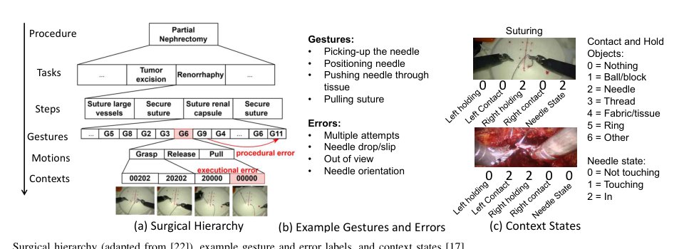 Real-Time Multimodal Activity-Aware Error Detection in Robot-Assisted Surgery Figure 1